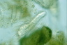 Chaetonotus hystrix