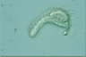 Chaetonotus hystrix