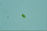 Trachelomonas cylindrica