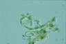Ophiocytium capitatum
