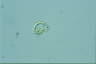 Ophiocytium parvulum
