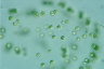 Tetraspora