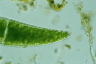 Closterium ehrenbergii