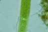 Closterium acerosum