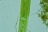 Closterium acerosum