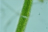 Closterium acerosum