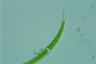 Closterium dianae