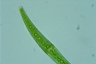 Closterium rostratum