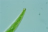 Closterium intermedium