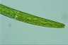 Closterium baillyanum