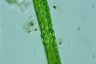 Pleurotaenium ehrenbergii