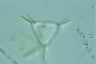 Staurastrum longispinum