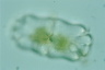 Euastrum crassum