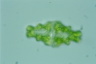 Euastrum humerosum