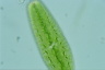 Netrium digitus