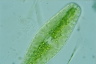 Netrium digitus