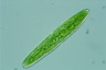 Tetmemorus granulatus