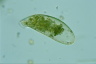 Cyphoderia ampulla