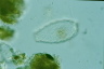 Euglypha bryophila