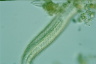 Chaetonotus zelinkai
