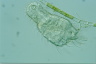 Chaetonotus cordiformis