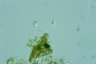 Salpingoeca urceolata