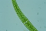 Closterium dianae