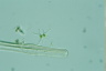 Staurastrum bibrachatum