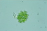 Euastrum spinulosum