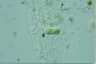 Cylindrocystis brebissonii