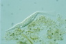 Dileptus gabonensis