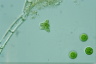 Staurastrum lapponicum