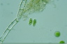 Staurastrum lapponicum