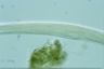 Spirostomum