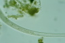 Spirostomum