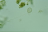 Clathrulina elegans
