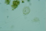 Clathrulina elegans