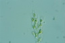 Dinobryon sertularia