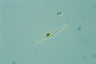 Gomphonema vibrio