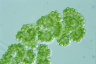 Botryococcus sudetica
