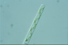 Spirogyra