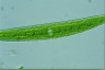 Closterium acerosum