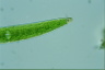 Closterium acerosum