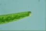 Closterium baillyanum