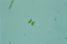 Staurastrum connatum