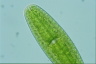 Netrium digitus