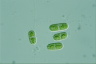 Cylindrocystis brebissonii