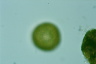 Arcella vulgaris