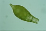 Difflugia acuminata