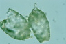 Difflugia elegans